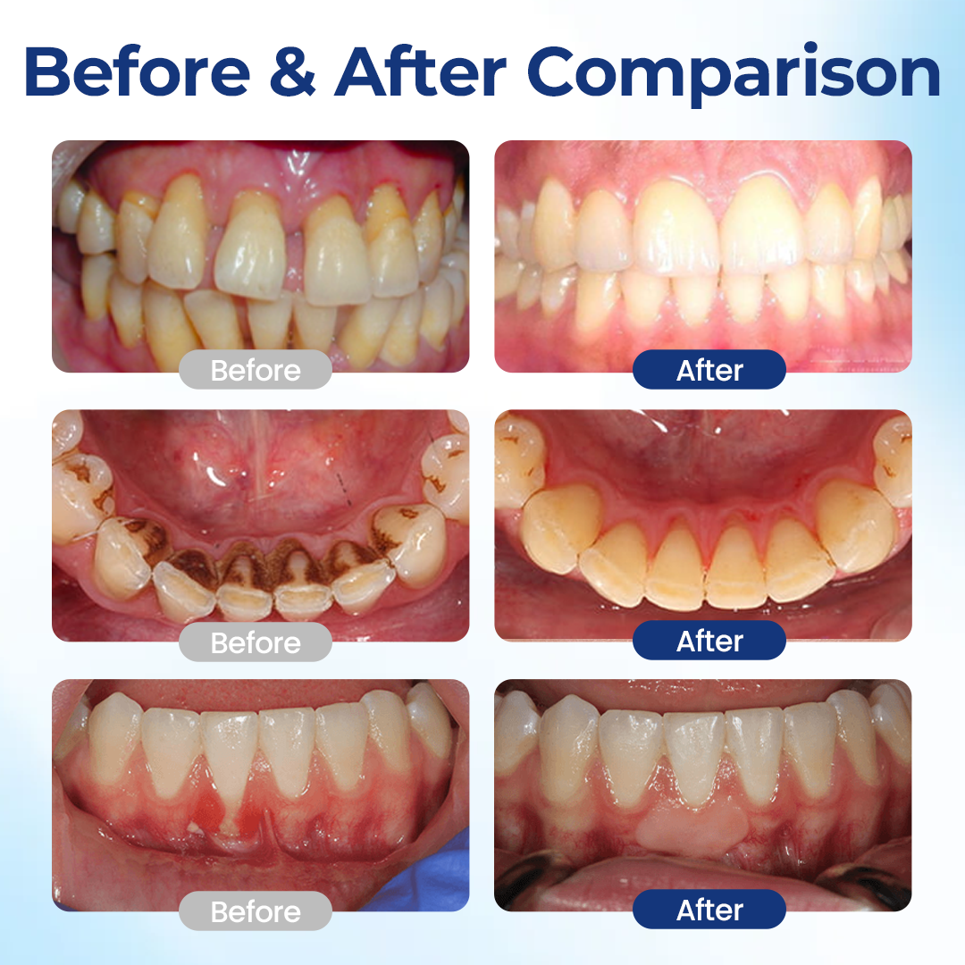 Zensu® BeeTakt Oral Repair Solution.