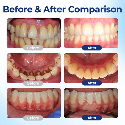 Zensu® BeeTakt Oral Repair Solution.
